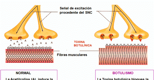 toxina-botulinica-mecanismo-de-accion